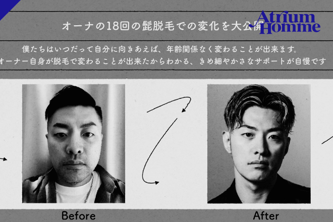【リアル体験】メンズヒゲ脱毛の効果は？オーナーのビフォーアフター写真で検証！｜ATRIUM HOMME 恵比寿
