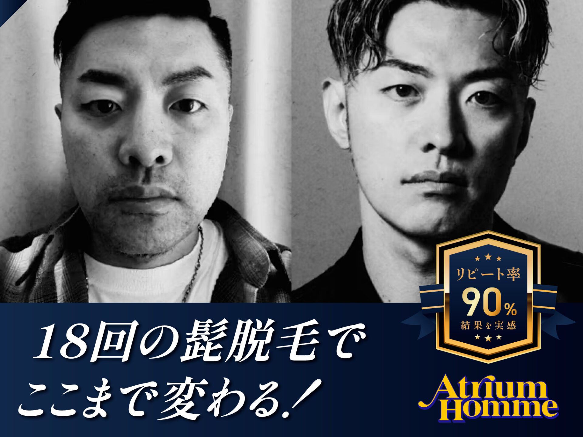 Google口コミ★4.8・リピート率90％ 恵比寿で選ばれるメンズ脱毛の実力｜ATRIUM HOMME 恵比寿