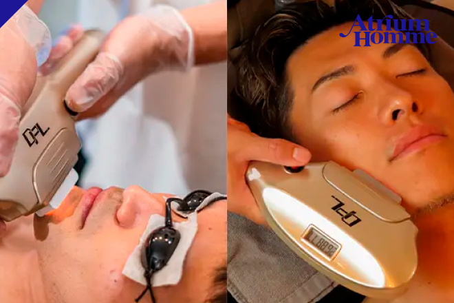 ヒゲ脱毛＋光フェイシャル ¥20,300→¥10,000セット効果で印象が劇的に変わる｜ATRIUM HOMME 恵比寿