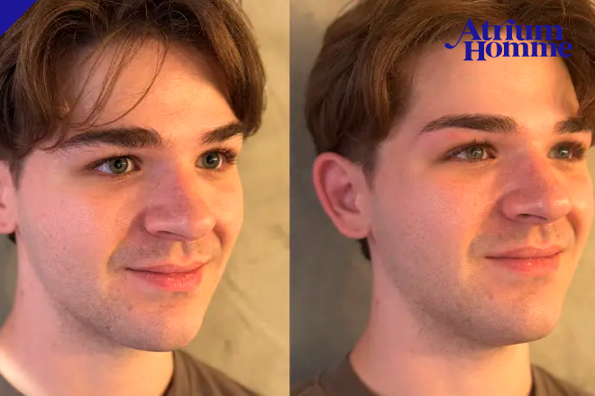 恵比寿 メンズ 眉毛サロン 女性からの印象はどう変わる?第一印象を上げる眉毛の整え方|ATRIUM HOMME 恵比寿