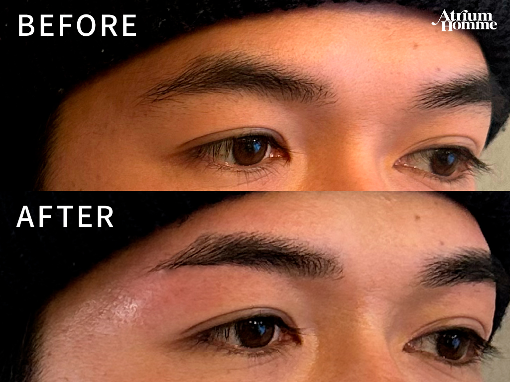 自然な眉毛で第一印象アップ|メンズ眉毛アイブロウWAXのビフォーアフターをご紹介|ATRIUM HOMME 恵比寿