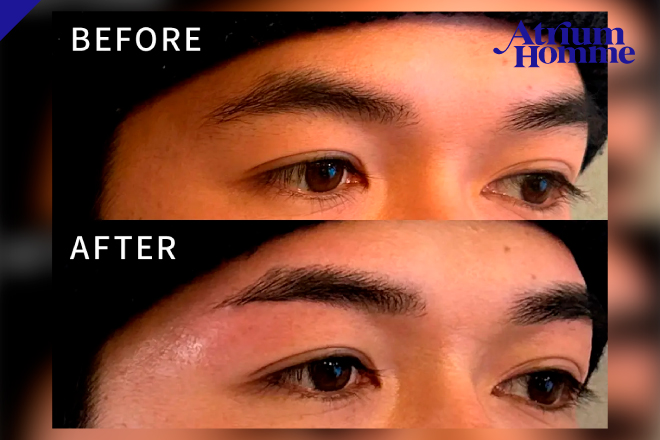 自然な眉毛で第一印象アップ|メンズ眉毛アイブロウWAXのビフォーアフターをご紹介|ATRIUM HOMME 恵比寿