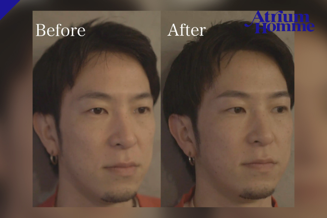 眉毛が薄い男性でも変わる?自然なメンズアイブロウの作り方|ATRIUM HOMME 恵比寿